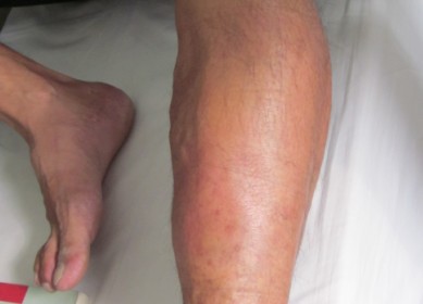 ȽŸʲôԭ ô滺Сȡ